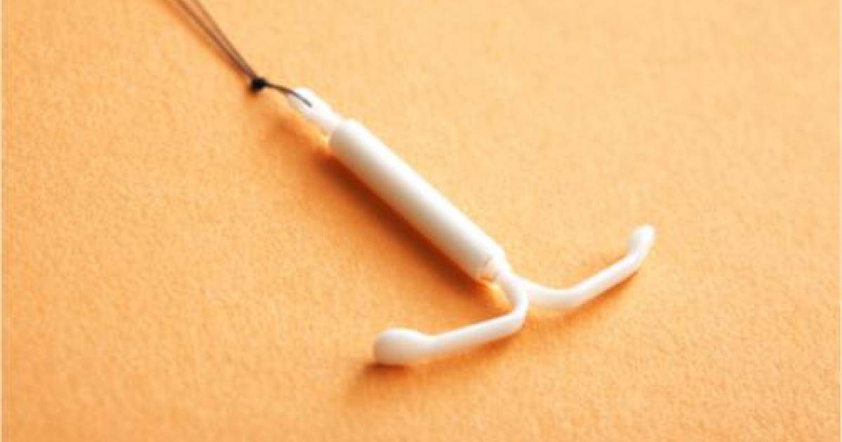 Iud Mirena